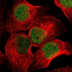 Immunofluorescent staining of human cell line A-431 shows localization to nucleoplasm.