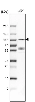 Western blot analysis in human cell line HEL.