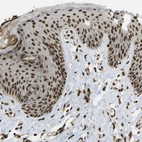 Immunohistochemical staining of human skin shows strong nuclear positivity in squamous epithelial cells.