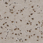 Immunohistochemical staining of human cerebral cortex shows strong nuclear positivity in neurons.