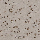 Immunohistochemical staining of human cerebral cortex shows strong nuclear positivity in neurons.