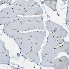 Immunohistochemical staining of human skeletal muscle shows strong nuclear positivity in myocytes.