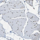 Immunohistochemical staining of human skeletal muscle shows strong nuclear positivity in myocytes.