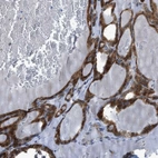 Anti-RBBP9 Antibody