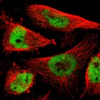 Immunofluorescent staining of human cell line U-251 MG shows localization to nucleoplasm.
