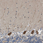 Anti-PCLO Antibody