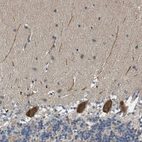 Anti-PCLO Antibody