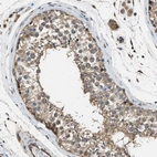 Immunohistochemical staining of human testis shows moderate membranous positivity in cells in seminiferous ducts.