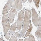 Immunohistochemical staining of human skeletal muscle shows very weak positivity in myocytes.