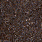 Immunohistochemical staining of human tonsil shows strong cytoplasmic positivity in non-germinal center cells.