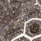 Immunohistochemical staining of human small intestine shows strong cytoplasmic positivity in glandular cells.