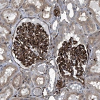 Immunohistochemical staining of human kidney shows strong cytoplasmic positivity in cells in glomeruli.