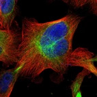 Immunofluorescent staining of human cell line U-251 MG shows localization to intermediate filaments.