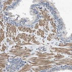 Immunohistochemical staining of human prostate shows moderate cytoplasmic positivity in smooth muscle cells.