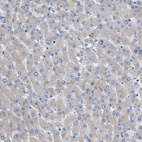 Immunohistochemical staining of human liver shows no positivity in hepatocytes as expected.