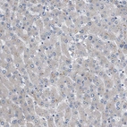 Immunohistochemical staining of human liver shows no positivity in hepatocytes as expected.