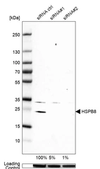 Western blot analysis in MCF-7 cells transfected with control siRNA, target specific siRNA probe #1 and #2, using Anti-HSPB8 antibody. Remaining relative intensity is presented. Loading control: Anti-GAPDH.