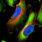 Immunofluorescent staining of human cell line U-251 MG shows localization to cytosol.