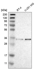 Western blot analysis in human cell line RT-4 and human cell line U-251 MG.