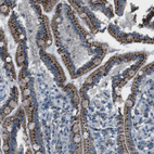 Immunohistochemical staining of human duodenum shows strong positivity in cytoplasm granular in glandular cells.