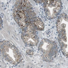 Immunohistochemical staining of human prostate shows weak to moderate positivity in cytoplasm granular in glandular cells.