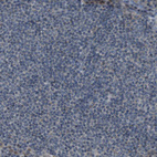 Immunohistochemical staining of human lymph node shows no positivity in germinal center cells as expected.