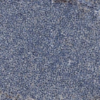 Immunohistochemical staining of human lymph node shows no positivity in germinal center cells as expected.