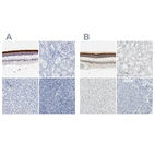 Anti-IMPG2 Antibody