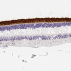 Immunohistochemical staining of human eye retina shows strong cytoplasmic positivity in rodes and cones cells.