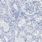 Immunohistochemical staining of human kidney shows no positivity in cells in tubules as expected.