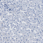 Immunohistochemical staining of human liver shows no positivity in hepatocytes as expected.