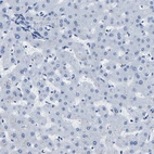 Immunohistochemical staining of human liver shows no positivity in hepatocytes as expected.