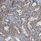 Immunohistochemical staining of human Kidney shows moderate granular cytoplasmic positivity in cells in tubules.