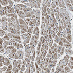 Immunohistochemical staining of human Heart muscle shows moderate granular cytoplasmic positivity in cardiomyocytes.