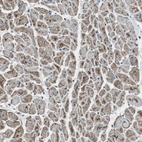 Immunohistochemical staining of human Heart muscle shows moderate granular cytoplasmic positivity in cardiomyocytes.