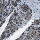Immunohistochemical staining of human parathyroid gland shows high expression.