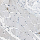 Immunohistochemical staining of human skeletal muscle shows low expression as expected.