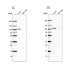 Western blot analysis using Anti-CTNND1 antibody HPA015954 (A) shows similar pattern to independent antibody HPA015955 (B).