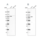 Western blot analysis using Anti-CTNND1 antibody HPA015955 (A) shows similar pattern to independent antibody HPA015954 (B).