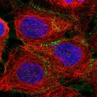 Immunofluorescent staining of human cell line A-431 shows localization to plasma membrane.
