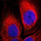 Immunofluorescent staining of human cell line A-431 shows localization to vesicles.
