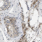 Immunohistochemical staining of human testis shows strong granular cytoplasmic positivity in Leydig cells.
