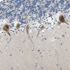 Immunohistochemical staining of human cerebellum shows strong granular cytoplasmic positivity in Purkinje cells.