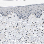 Immunohistochemical staining of human skin shows no positivity as expected.