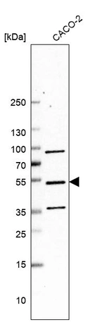 Western blot analysis in human cell line CACO-2.