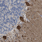 Anti-RNF112 Antibody