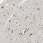 Immunohistochemical staining of human cerebral cortex shows weak cytoplasmic positivity in neurons.