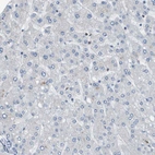 Immunohistochemical staining of human liver shows no positivity in hepatocytes as expected.