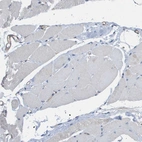 Immunohistochemical staining of human skeletal muscle shows no positivity in myocytes as expected.