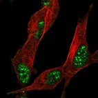 Immunofluorescent staining of human cell line SH-SY5Y shows localization to nuclear speckles.
